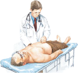 HYDROCELE ถุงน้ำลูกอัณฑะ