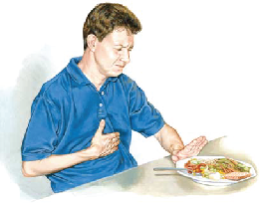 มะเร็งหลอดอาหาร(esophageal cancer)