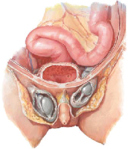 UNDESCENDED TESTICLEการไม่มีลูกอัณฑะในถุงอัณฑะ