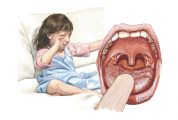 Hand, Foot, and Mouth Disease