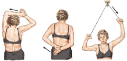 Frozen Shoulder 