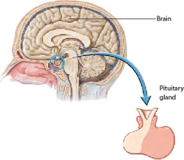Pituitary Adenomas 