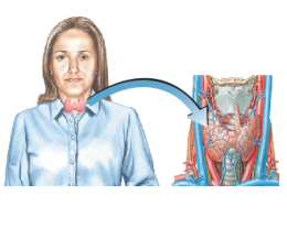 Thyroiditis 