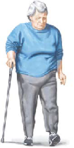 OSTEOARTHRITIS