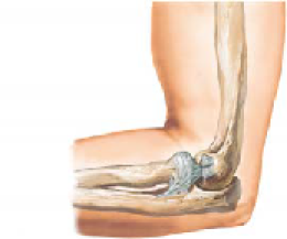 Tennis Elbow 