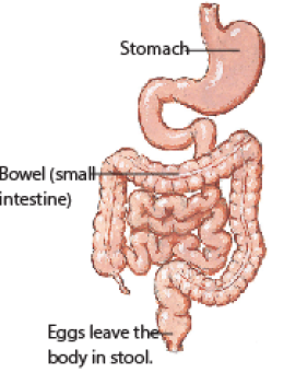 Cysticercosis 