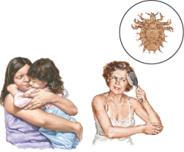  Lice
