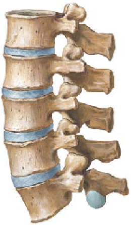 Back Pain 