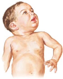 Botulism 