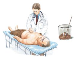 Giardiasis 