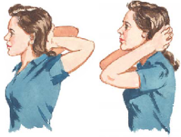 Costochondritis 