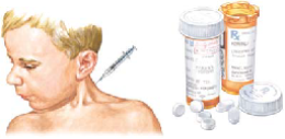 Torticollis 
