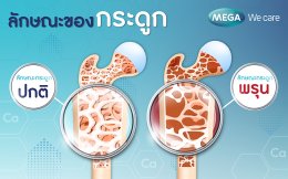 The association between 'calcium' and osteoporosis.
