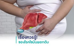 'ไขมันพอกตับ' ต้นเหตุตับป่วยที่ไม่ควรมองข้าม