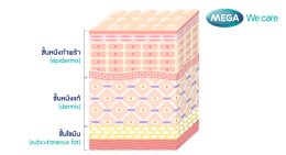 เคล็ดลับหน้าใส ไม่ต้องฉีดฟิลเลอร์ ลดริ้วรอยด้วยคอลลาเจน