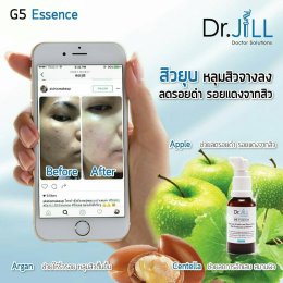 Dr JiLL รีวิว ผลการใช้จริง *สงวนสิทธิ์การนำภาพไปใช้โดยไม่ได้รับอนุญาต