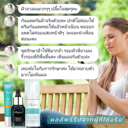 รีวิว เซรั่มสลายฝ้า