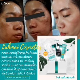 รีวิว เซรั่มสลายฝ้า