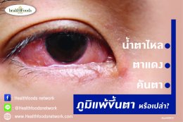 น้ำตาไหล ตาแดง คันตา คุณเป็นภูมิแพ้ขึ้นตาหรือเปล่า?