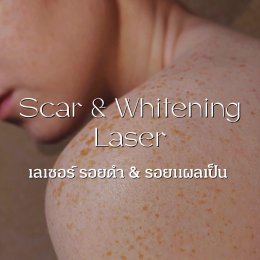 SCAR & WHITENING
