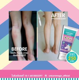 เจลทาหลังยุงกัด Unicorn Magic Gentle Soothing Gel