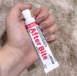 ครีมทาหลังยุงกัด After Bite 