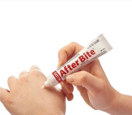 ครีมทาหลังยุงกัด After Bite 