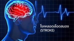 อาการของโรคหลอดเลือดสมอง ( STROKE )