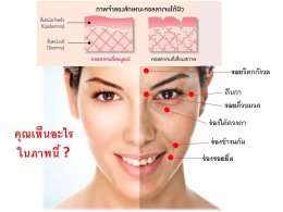 เช็ค 3 อาการ ร่างกายขาด คอลาเจนไหม?