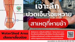 เจาะลึกปวดเอ็นร้อยหวาย : สาเหตุที่หายช้า