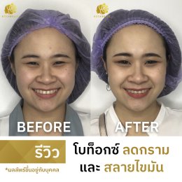 รีวิวโปร DOUBLE V