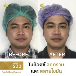 รีวิวโปร DOUBLE V
