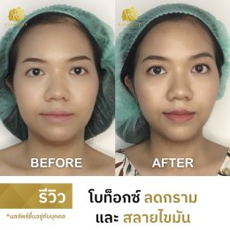 รีวิวโปร DOUBLE V