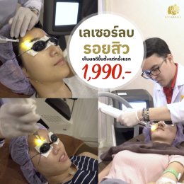 รักษารอยสิว เลเซอร์รักษารอยสิวอย่างเห็นผล ที่โรสเบลล์คลินิก