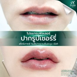รีวิววววววว