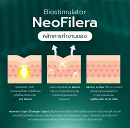 NEOFILERA