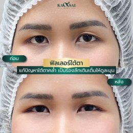 รีวิววววววว