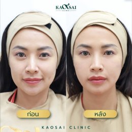 รีวิววววววว