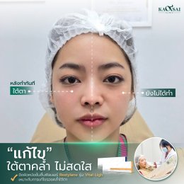 รีวิววววววว