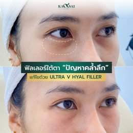 รีวิววววววว