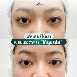 รีวิววววววว