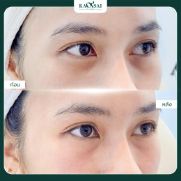รีวิววววววว