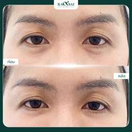 รีวิววววววว