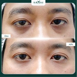 รีวิววววววว