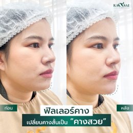 รีวิววววววว