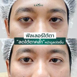รีวิววววววว