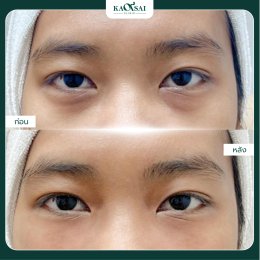 รีวิววววววว