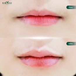 รีวิววววววว