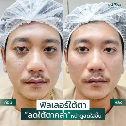 รีวิววววววว