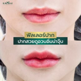 รีวิววววววว